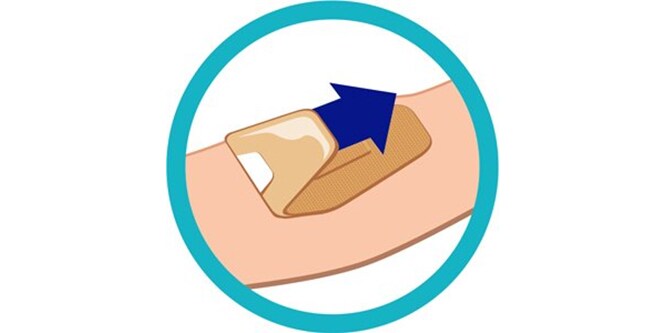Ein Diagramm zeigt das korrekte Ablösen eines Nexcare™ DUO-Pflasters

